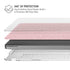 Rose Speckle MacBook Pro 14in (2021-24) Case plus Skin